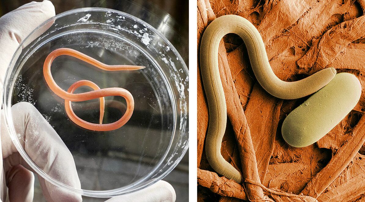 parazīti cilvēka organismā