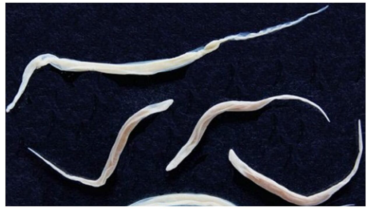 Pinworms ir izplatīti parazīti, kas pieder pie helmintu grupas.