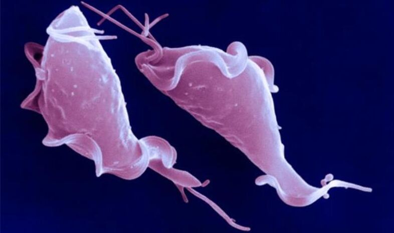 Trichomonas vaginalis ir vienšūņu parazīts, kas izraisa neauglību.